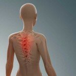 Перелом позвоночника Перелом позвоночника