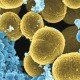 Золотистый стафилококк Золотистый стафилококк